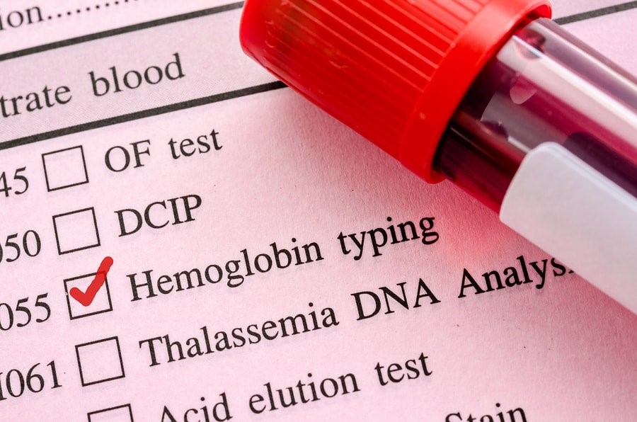 hb in blood test and interpretation of its results