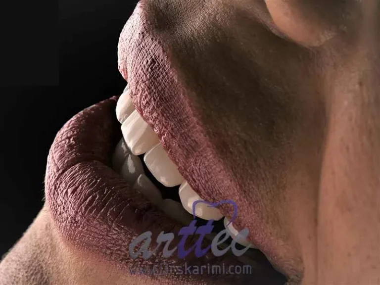 تفاوت ارتودنسی با لیزر و لمینت دندان چیست؟