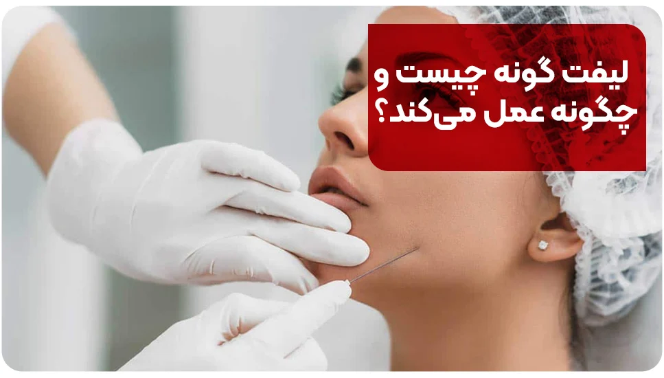 لیفت گونه چیست و چگونه عمل می&zwnj;کند؟