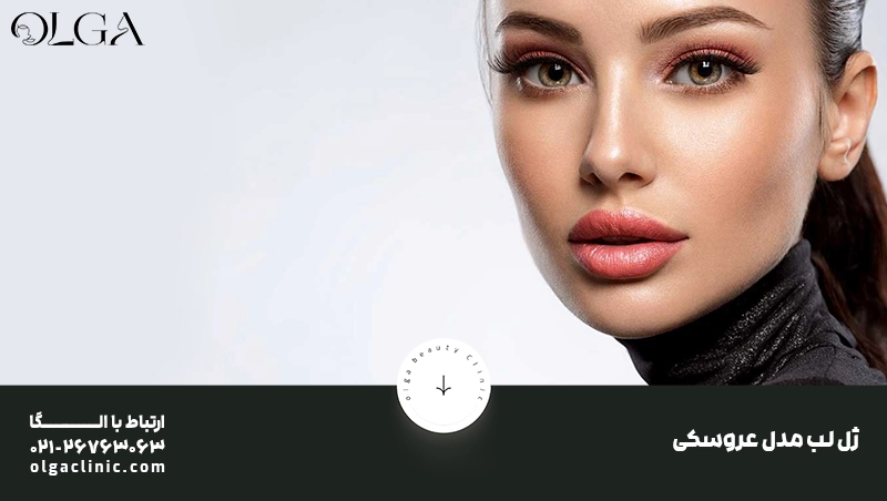 ژل لب مدل عروسکی چیست؟